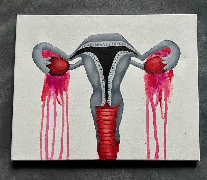  painted uterus in black and white. red blood drips from ovaries down the length of the painting 